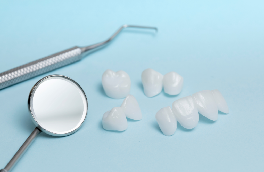 Conheça os tipos de facetas dentais e os benefícios de cada um